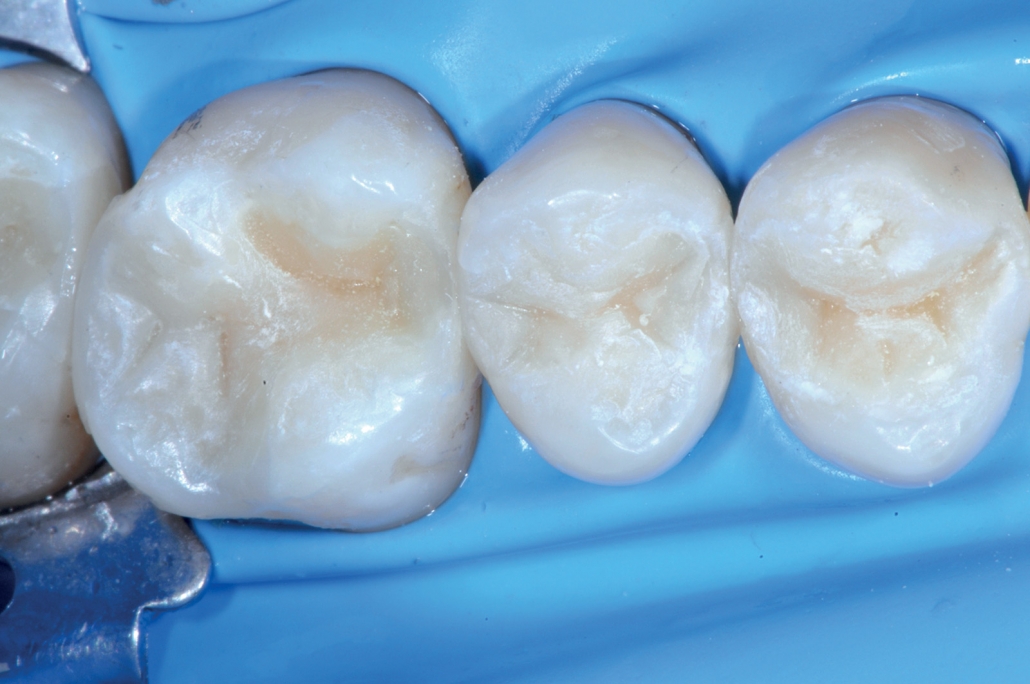 conservativa e endodonzia